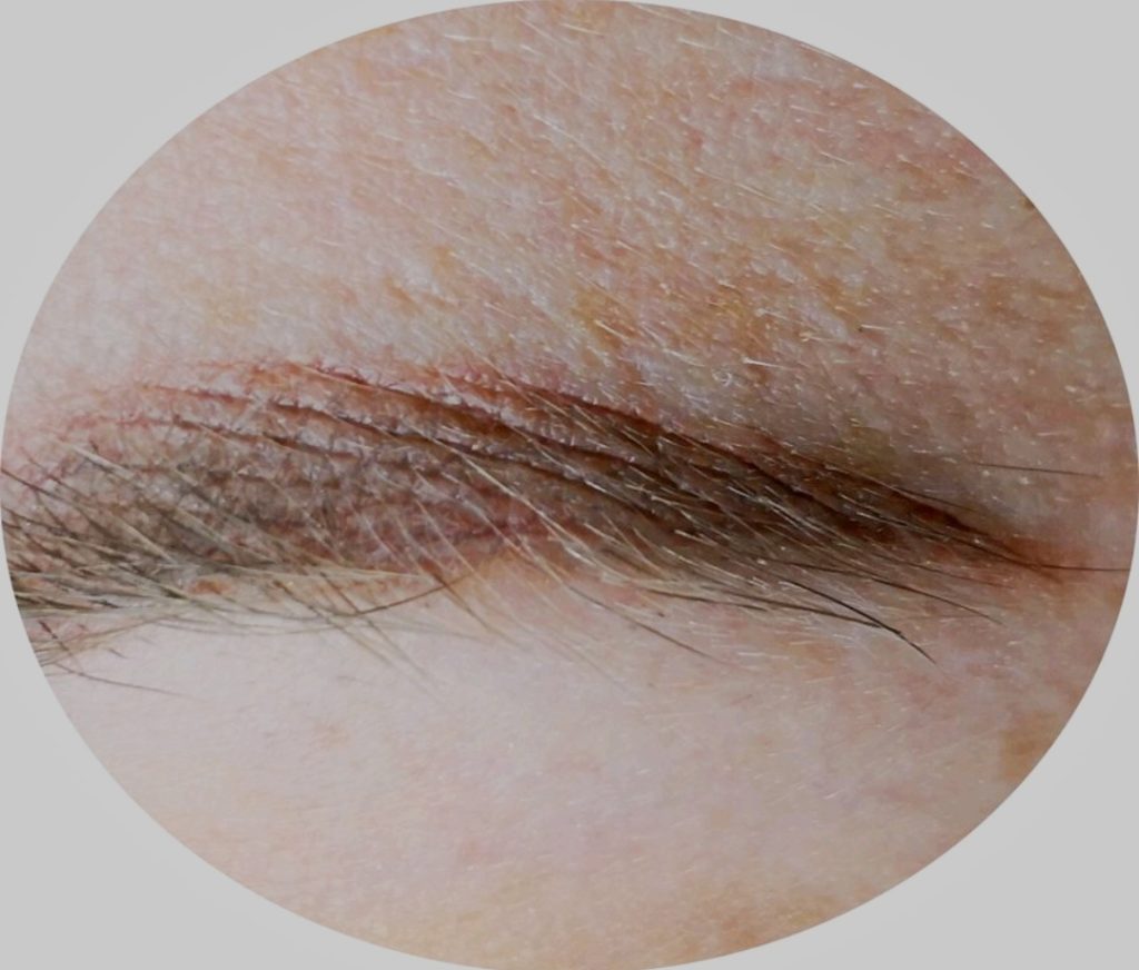 microblading attention aux dégâts