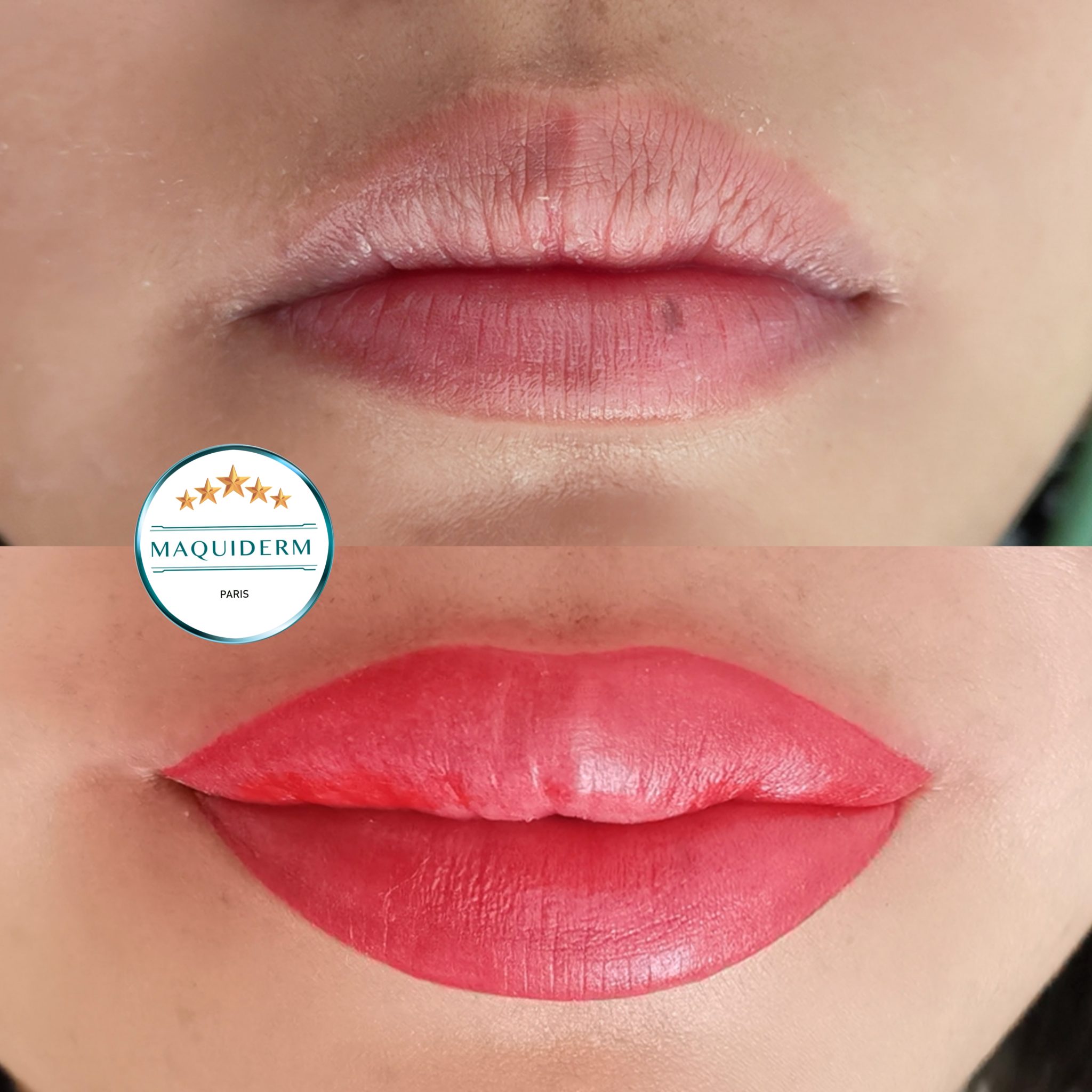 Le maquillage permanent des lèvres MAQUIDERM©