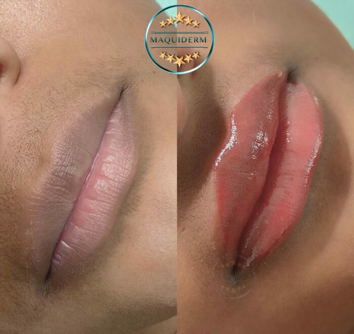 maquillage permanent des lèvres foncées