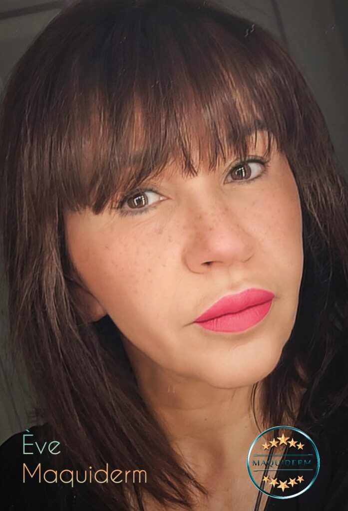 Formation tache de rousseur