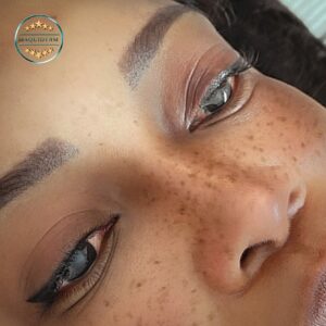 Taches de rousseur