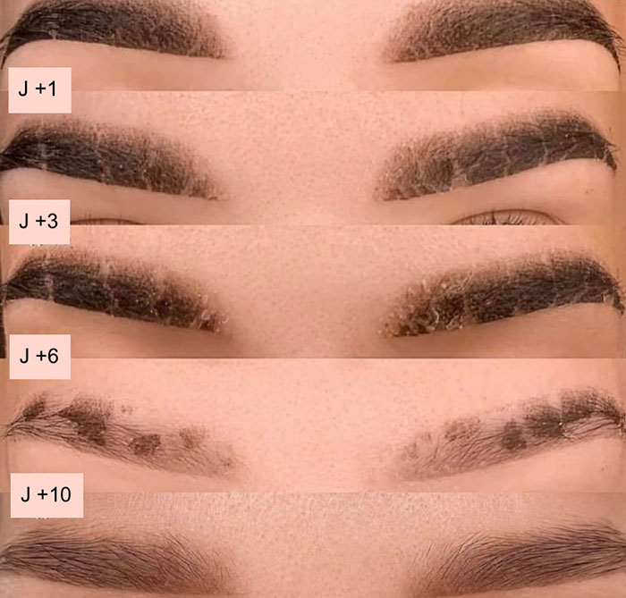 Cicatrisation du maquillage permanent des sourcils