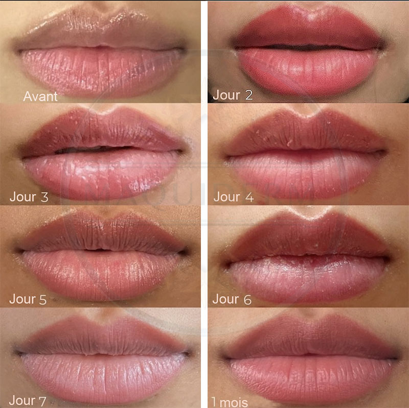 Cicatrisation du maquillage permanent des lèvres