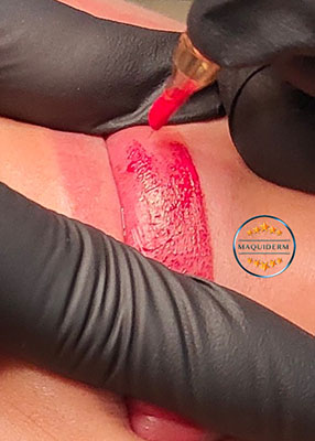 dermopigmentation des lèvres