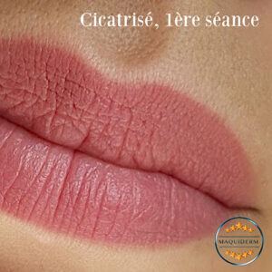 Maquillage permanent des lèvres lip blush cicatrisé