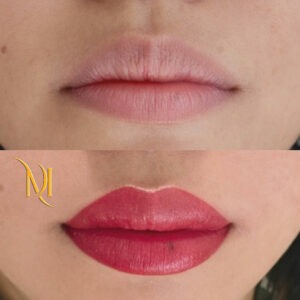 Avant après maquillage permanent lèvres full color, résultat uniforme et naturel