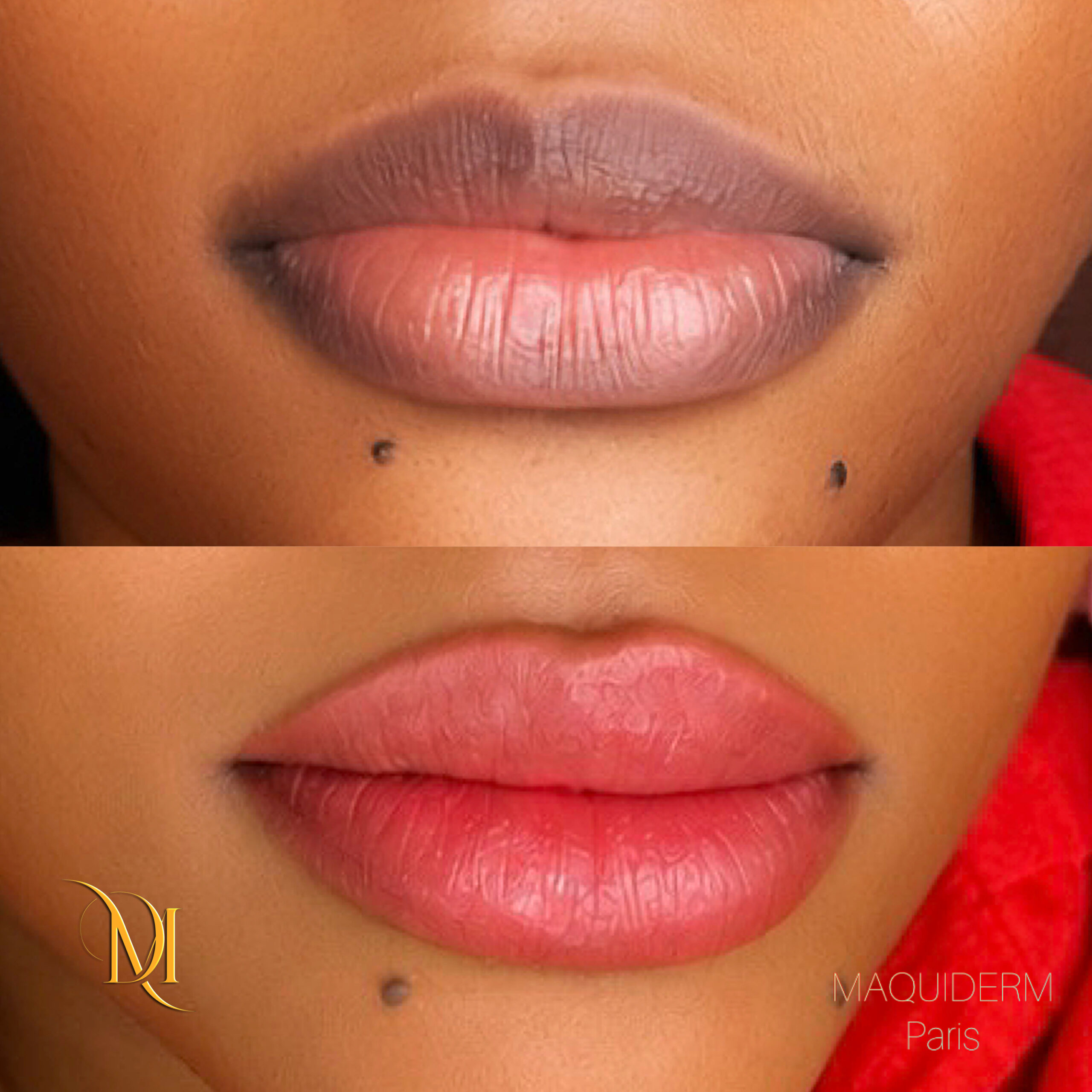 Maquillage permanent des lèvres avant après à Paris